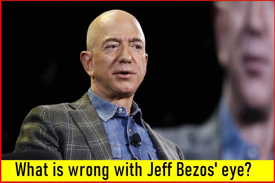 What is wrong with Jeff Bezos' eye